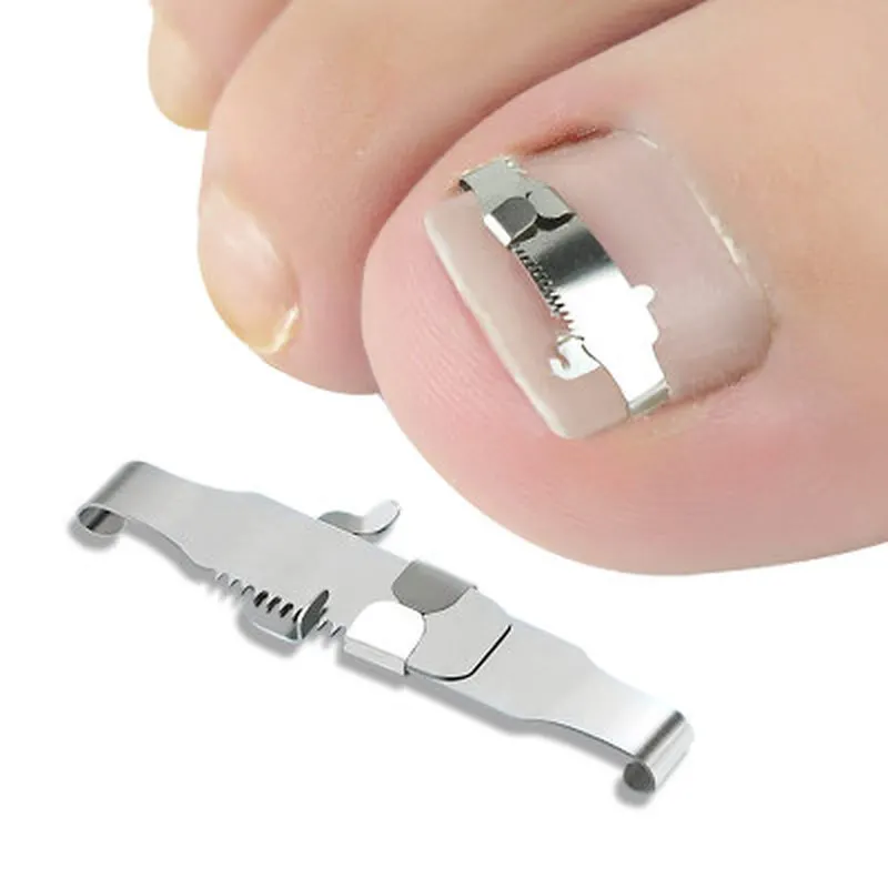 Cut Rate Ingrown Toenail Corrector Foot-Care-Tools Pedicure Embed-Tool Nail-Fixer Orthotic Recover GmJXxaNwd