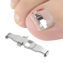 Correcteur d'ongles incarnés, outil orthopédique de pédicure, traitement des ongles incarnés, outils de soins des pieds