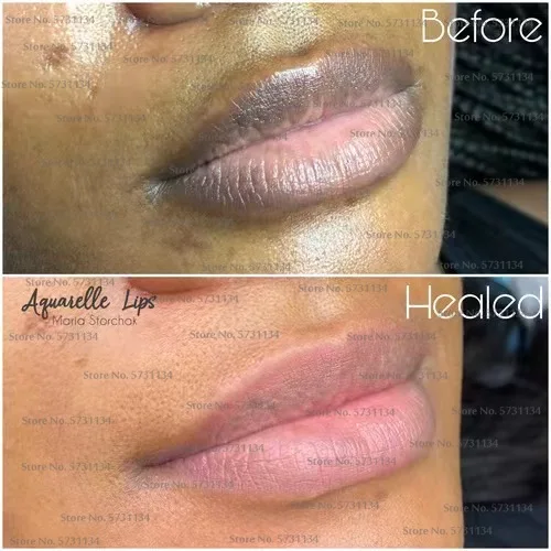 Lip care Of Lips Pink Fresh Lightening Bleaching Cream Treatment Remove Dark Smoke Lips lip oil 4