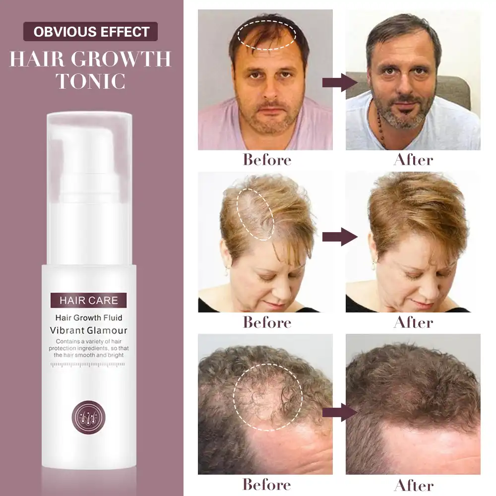 Hair Growth Serum Essence Oil Anti Hair Loss Treatment Spray Hair