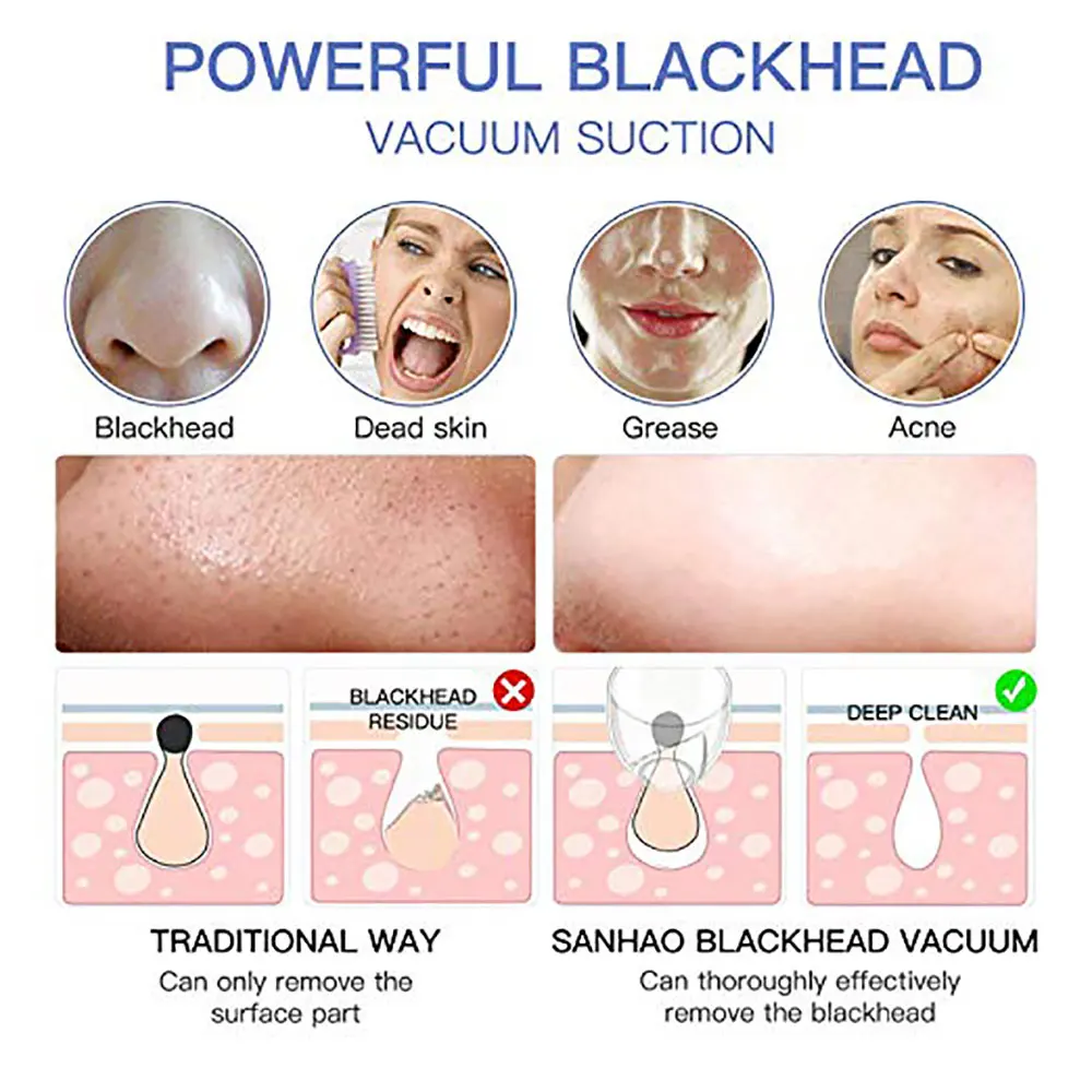 Removedor de Cravo Cuidados com a Pele Freshme Rosto Profunda Poros Limpador Acne Espinha Remoção Puntos Negros Sucção Facial Spa Ferramenta 3 facial spa ferramenta cuidados com a pele