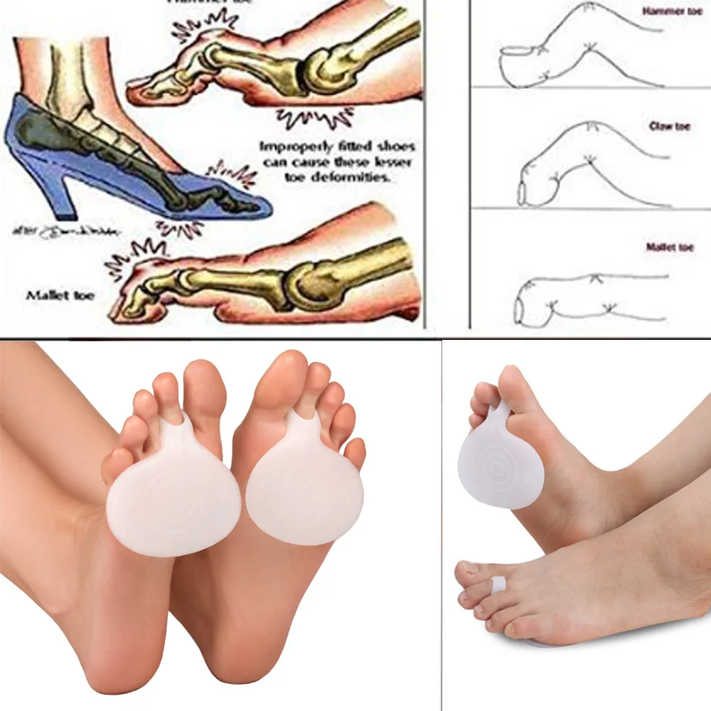 2Pcs Thick Medical Silicone Toe Pads Gel Forefoot Pad Feet Care High heels Half Insole Foot Care Sore Feet Pain Pedicure Z52401