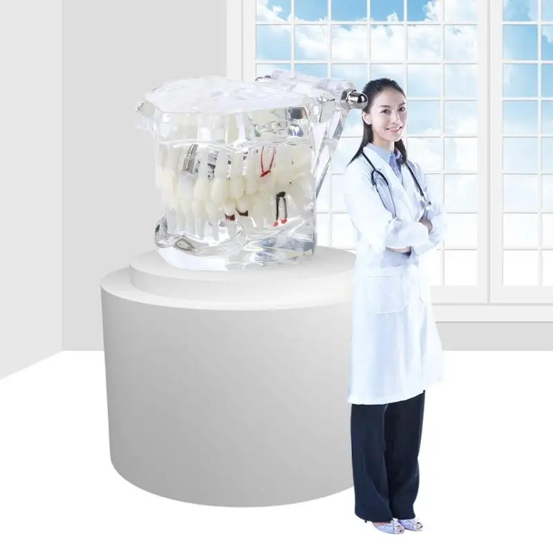 Горячая Распродажа модель зубного импланта для медицинского обучения уход за