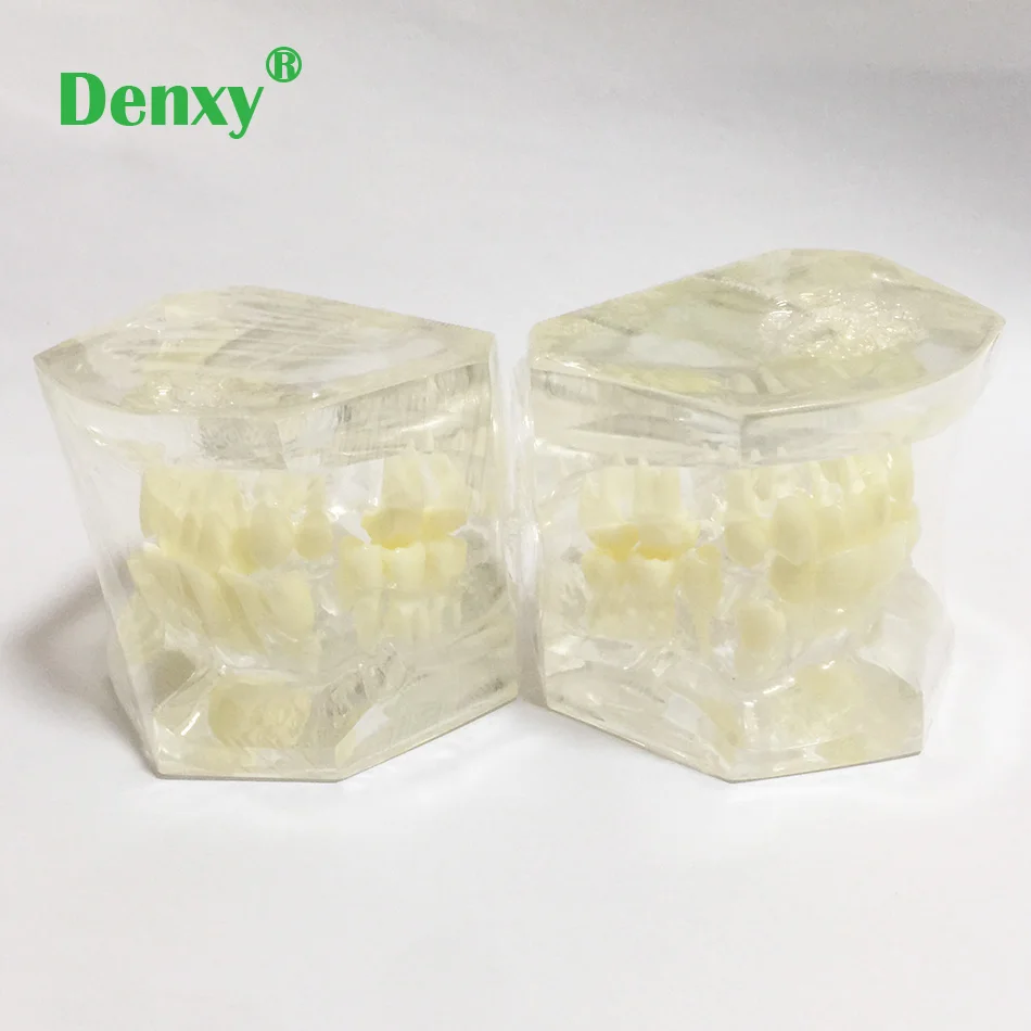 Denxy 2 шт ортодонтический, для зубов Модель Стоматологическое заболевание Зуб модель зубной полости в школьном Орто донтическом кронштейнах