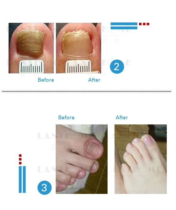 Lanthome лосьон для ногтей ремонт, защита ногтей гладкая, ремонт повреждения ногтей, восстановление цвета ногтей