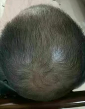 Sevich-espray de esencia para el crecimiento del cabello para hombres y mujeres, tratamiento para la pérdida del cabello, nutre las raíces, fácil de llevar, cuidado del cabello Germinal rápido, 30g