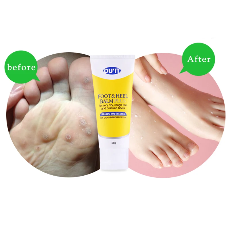 DU'IT Foot& Heel Balm Plus Ремонт очень сухих, грубых трещин на стопах и пятках, Нежирный крем для ног, 5 дней на ремонт трещины пятки