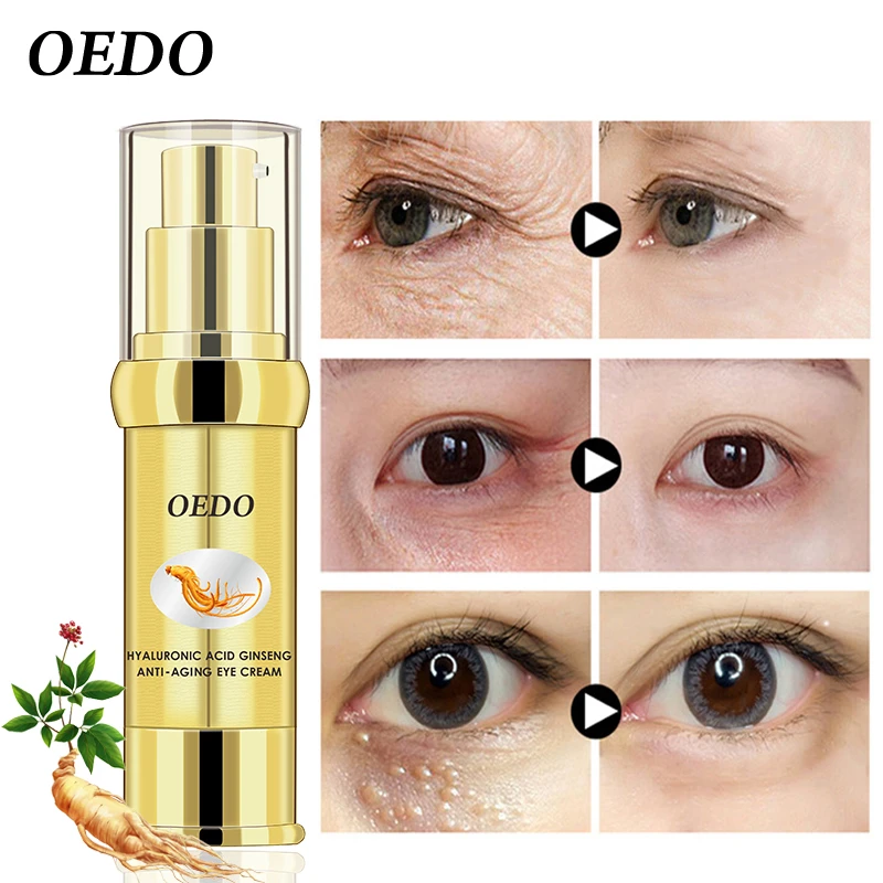 dark circles hyaluronic acid