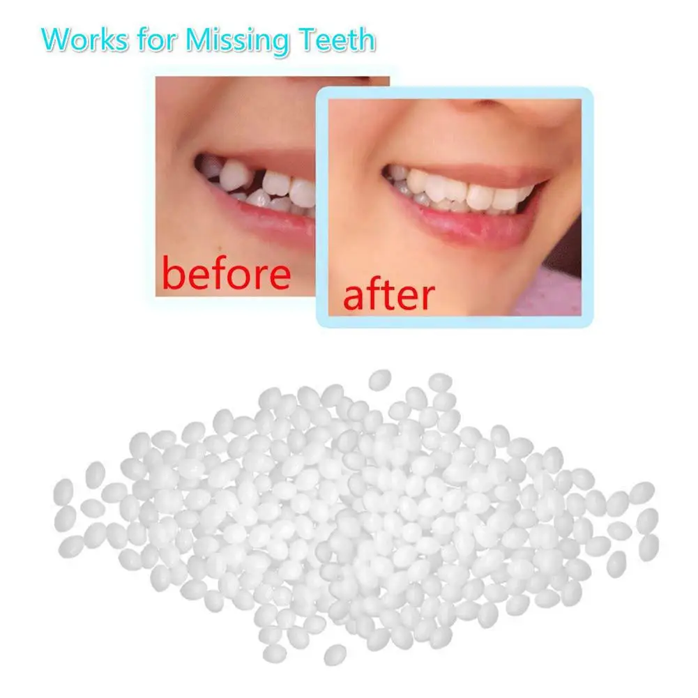 

Dental Denture Temporary Restoration Solid Glue Tooth Repair Kit Oral Care Tool uneven teeth and missing teeth until you can get