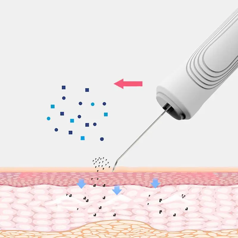 Скребок для кожи лица Электрический спа нежный удаления угрей ультразвуковая поверхность очиститель
