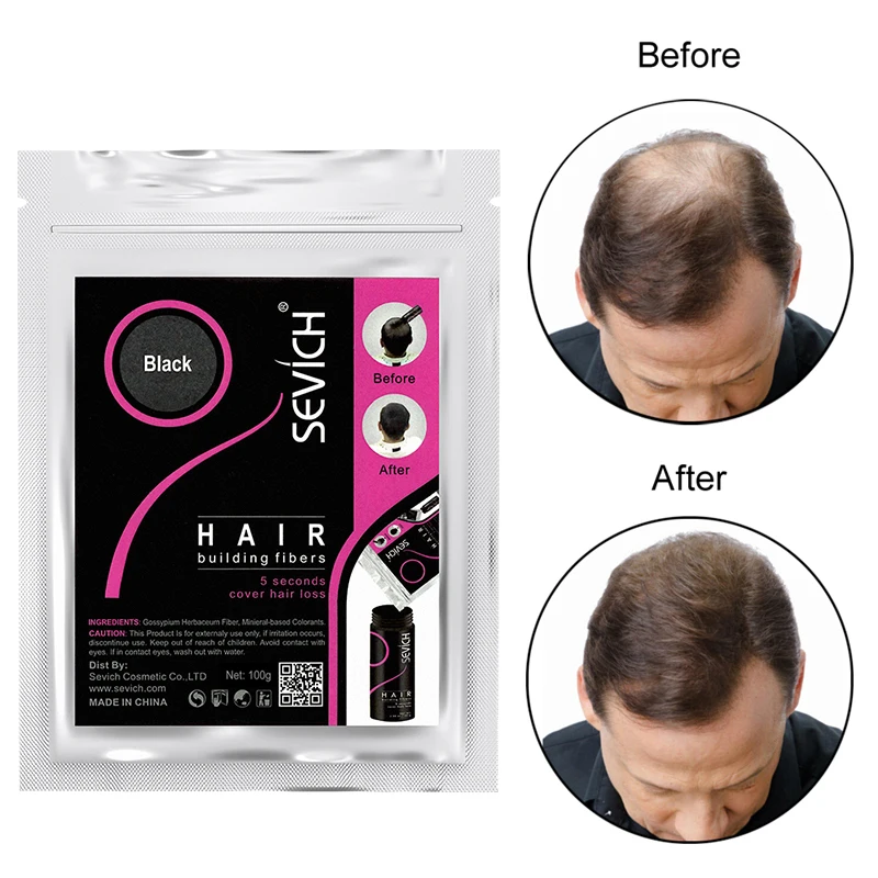 

Sevich 50g/100g Hair Building Fibers Hair Loss Concealer Product Hair Extention Keratin Fiber Powder Hair Care Growth
