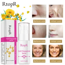 RtopR Gold Polypeptide Anti Aging Face Serum Hyaluronic Acid Moisturizing Whitening Shrink Pores Anti-wrinkle Firming Skin Care