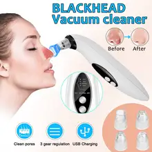 Средство для удаления угрей, черных точек, прыщей, угрей для лица, электрический пылесос для угрей, пористая кожа, инструменты для ухода, машина с 4 головками