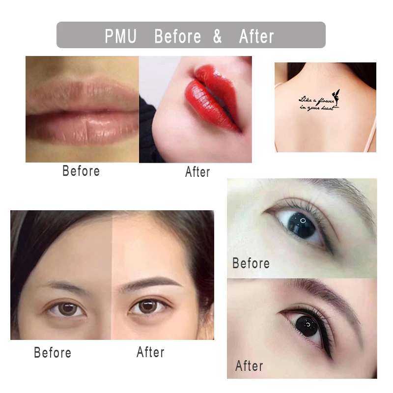 Мезороллер mezopen Microneedling Derma Pen Dr.Pen M7 C Auto Microneedle Bayonet Prot игольчатый картридж для