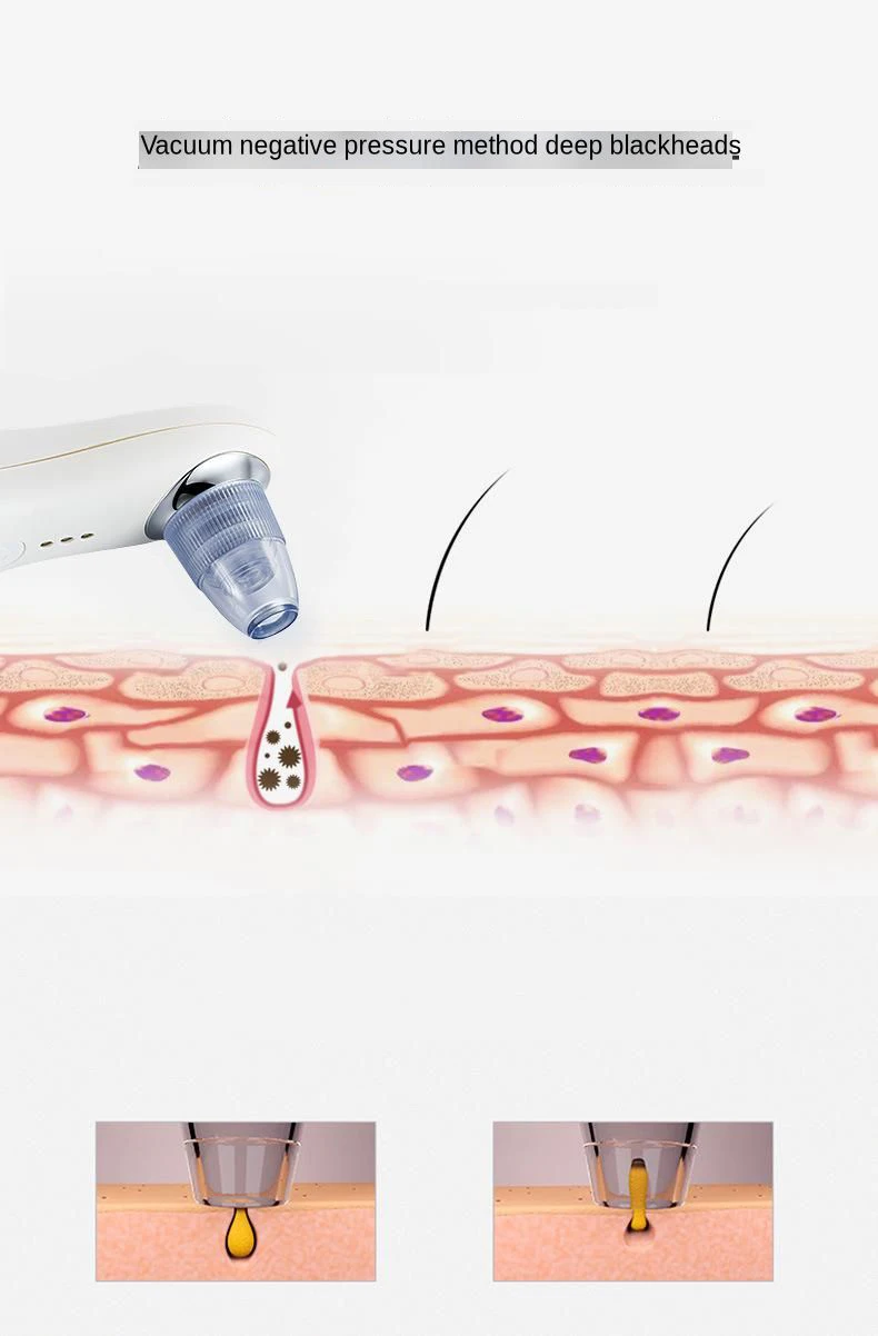 Aspirador de pó Remoção da Pele Poros Acne Espinha Máquina Aperto Zona Nariz Preto Cabeça Extrator Encolhimento Dermabrasion Beleza 14 Cheap Utensílios de cuidado facial
