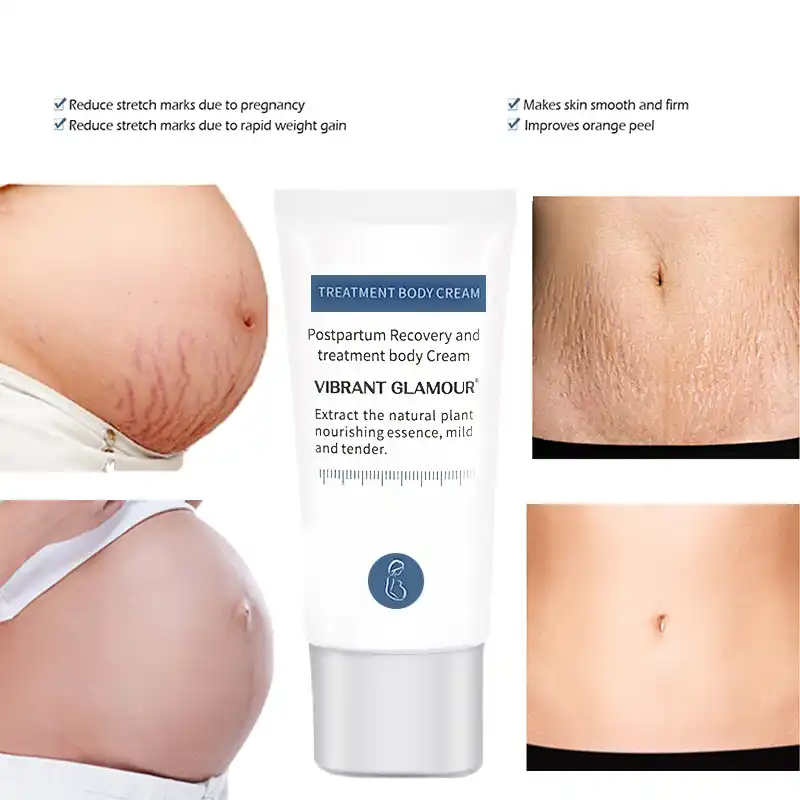 crocodile cream for stretch marks