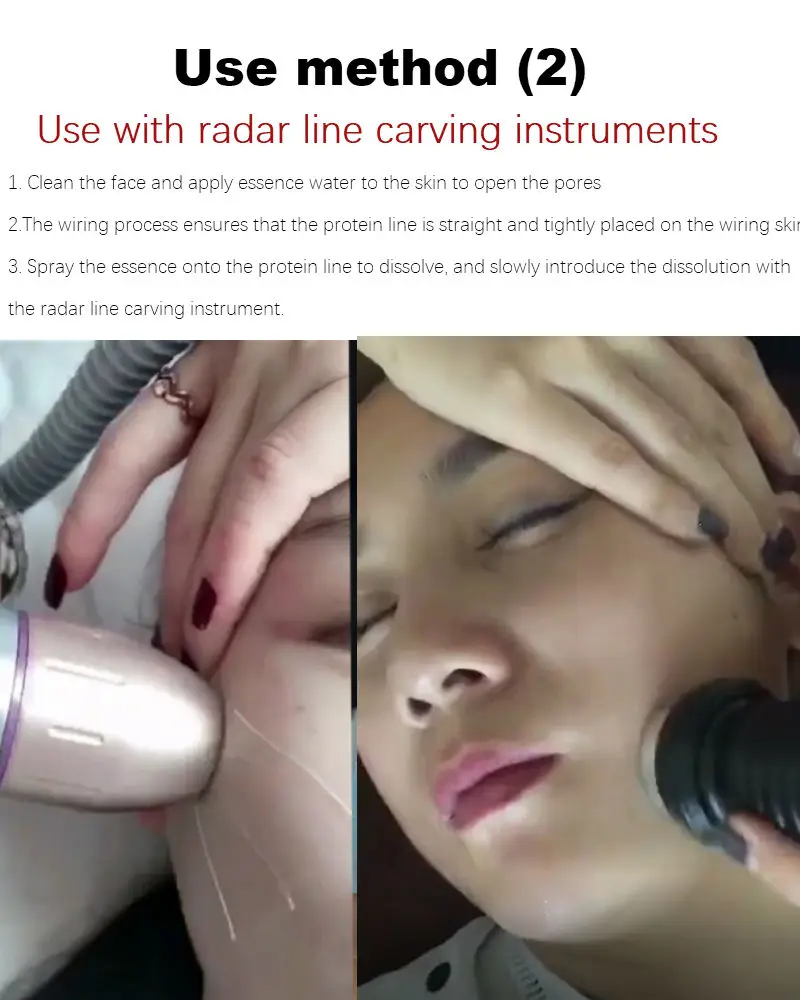 Рисунок 6 - 600 мешков, радар шелковой белковой линии без иглы