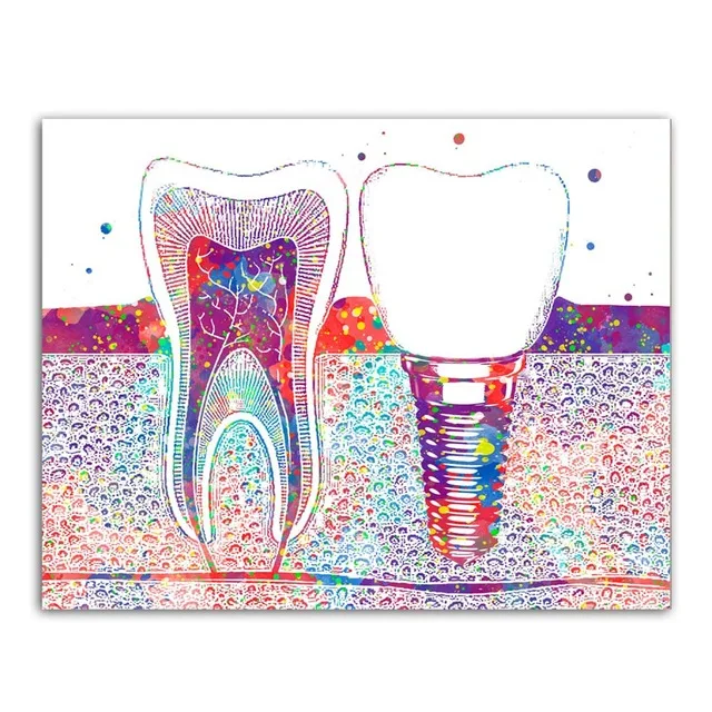 WANGART-Watercolor-Painting-Teeth-Print-Surgical-Instrument-Canvas-Art-Wall-Picture-For-Medical-Education-Office-Home.jpg_640x640 (1)