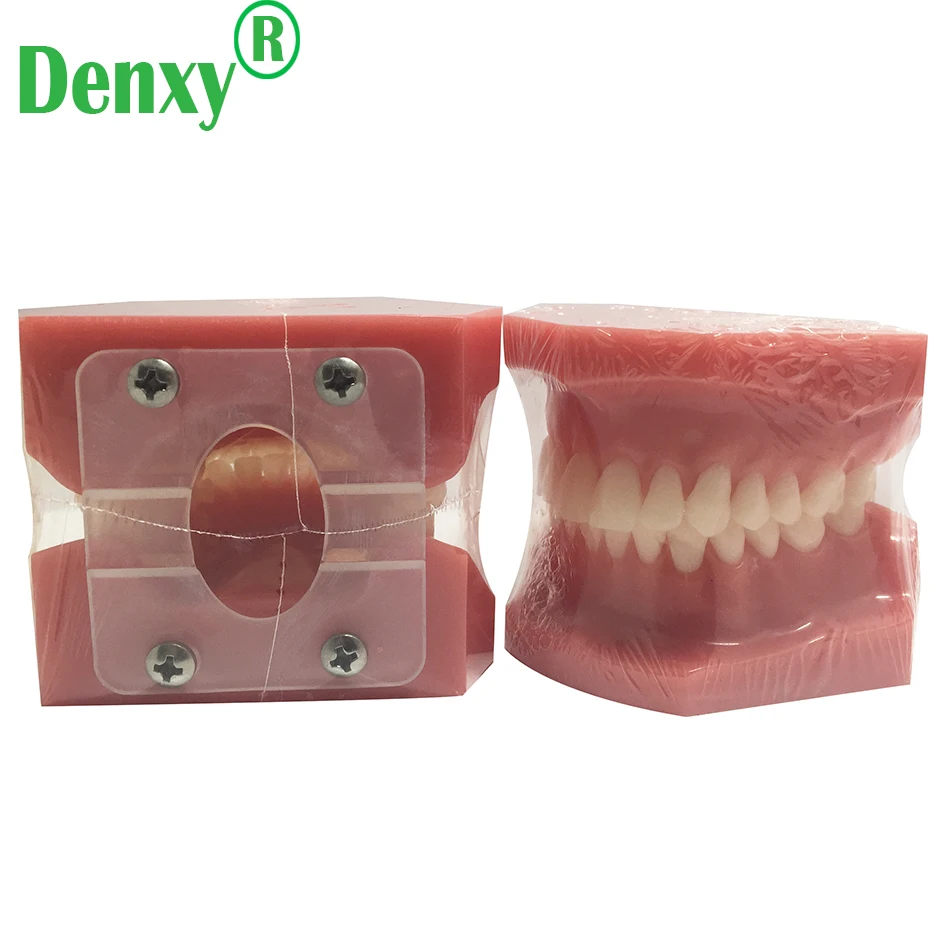 no brace red dental model