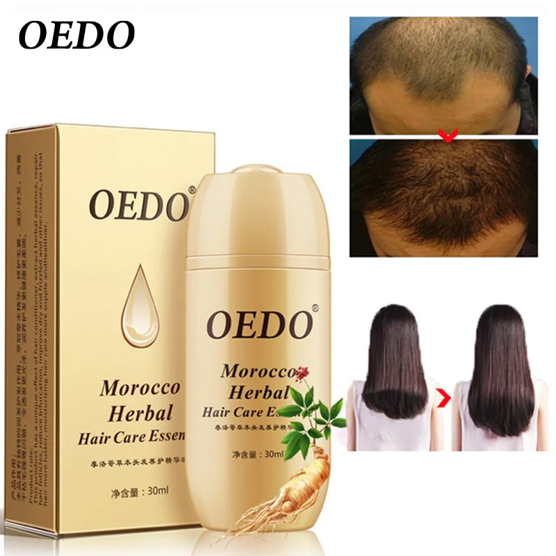 30ML Moroccan Hair Loss Treatment Ginseng Ginger Hair Growth Oil Herbal For Dry Hair Care Types Scalp Herbal Treatment Essence 30ML Moroccan Hair Loss Treatment Ginseng Ginger Hair Growth Oil Herbal For Dry Hair Care Types Scalp Herbal Treatment Essence