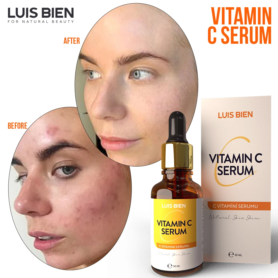 Luis Bien C Essence Whitening Anti Aging Wrinkle Face Serum Anti Acne Spots Freckles Remove Skin Care 30 ML|BB & CC Creams| - AliExpress