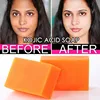 100g Handmade Kojic Acid Essential Oil Soap Face Body Dark Black Skin Whitening Brighten Deep Cleansing Removal Mites Bath Soap