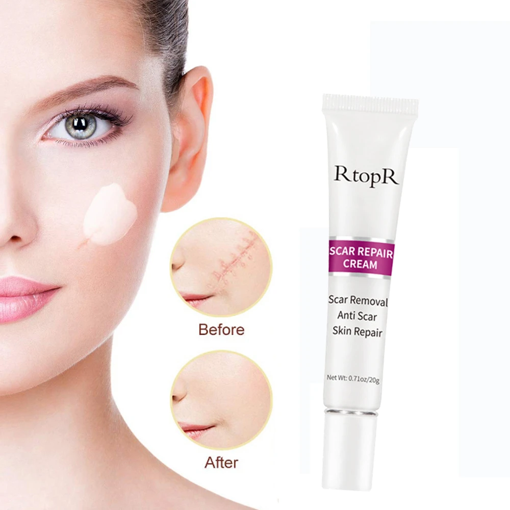 20g Repairing Essence Cream Remove Scars Surgical Wounds After