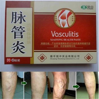

6 Pcs Spider Veins Varicose Treatment Plaster Varicose Veins Cure Patch Vasculitis Natural Herbal Patches,medicine past