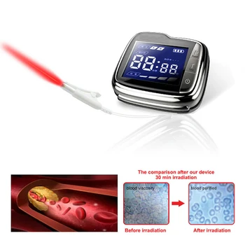 

Medical Laser High Blood Pressure and Diabetes Treatment Laser Therapy Watch Diode Laser Vascular Therapy Equipment
