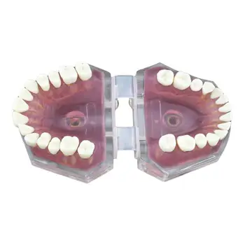 

1pc 28 Teeth Model Detachable Standard Dental Teaching Model Dental Practicce Tool for Dentists
