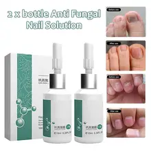 Антибактериальный уход восстановление ногтей жидкое решение для ногтей Инструменты для ремонта ногтей Уход за ногтями на ногах улучшение инфекции