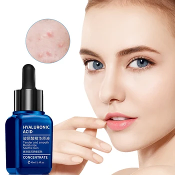 

MICAOJI Hyaluronic Acid Face Serum Nicotinamide Whitening Moisturizing Essence Shrink Pores Anti-aging Repair Firming Skin Care