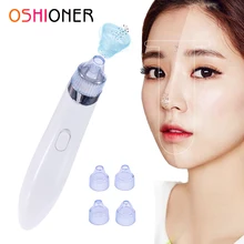 Средство для удаления угрей многофункциональное средство для очищения пор лица очиститель кожи инструмент для удаления угрей