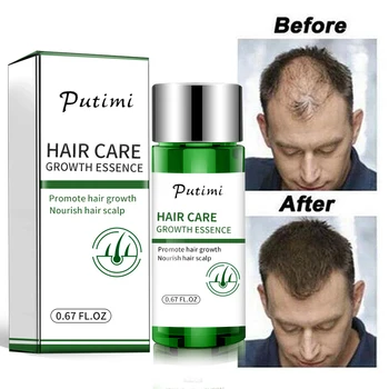 

Putimi Hair Growth Serum Prevent Hair Loss Fast Growth Essence Natural Hair Growing Serum Restoration Essence Thicken TSLM1