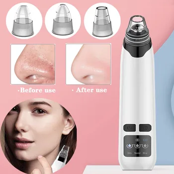 

Electric blackhead removal acne facial hot compress open pores deep cleansing nose T area facial pore cleaner skin care