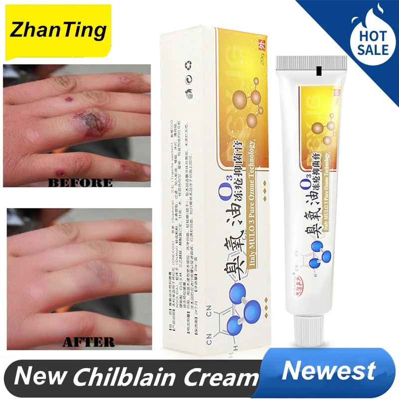 

ZhanTing Crack Cream Horse Oil Hand Foot Crack Cream Heel Chapped Peeling Foot Hand Repair Anti Dry Crack Skin Ointment Cream