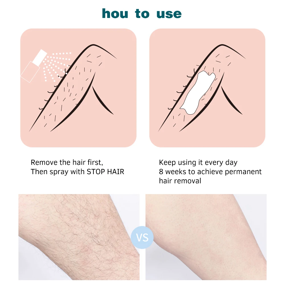 20 мл Перманентный ингибитор роста волос спрей для бороды Бикини Интимные ноги