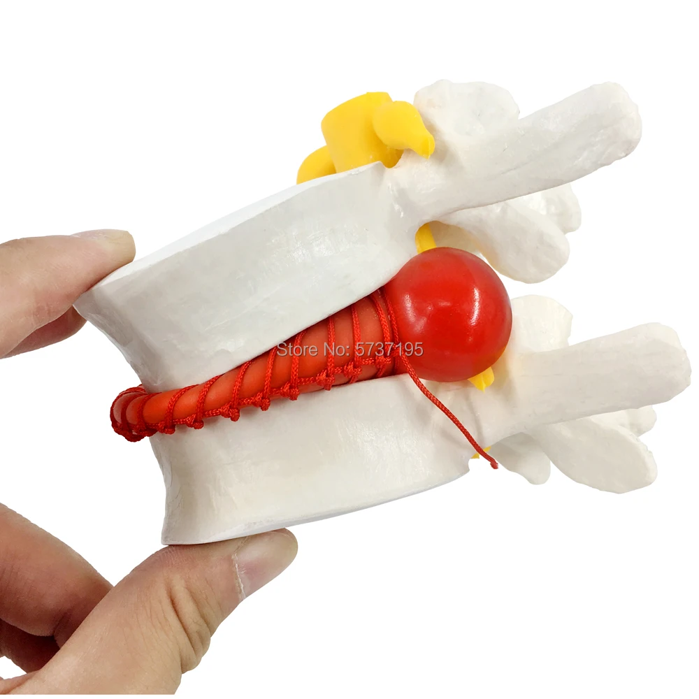 

Human anatomy skeleton spine model with nerve Disc herniation teaching tool medical supplies free shipping for USA
