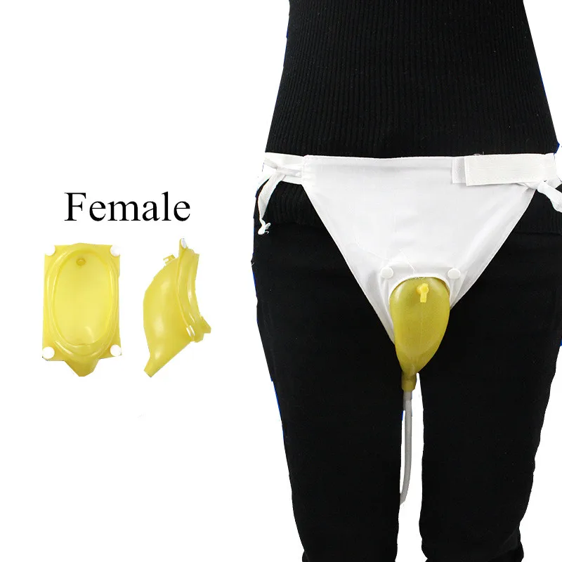 Aggregate 142+ living with a catheter bag latest kidsdream.edu.vn