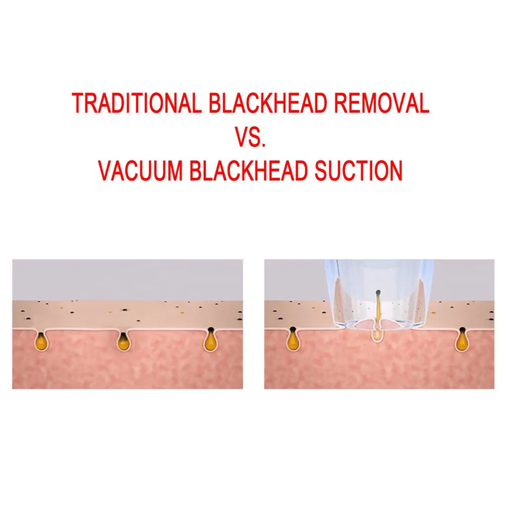 USB Rechargeable Pores Vacuum Electric Face Pore Cleaner Blackhead Remover Acne Suction Facial Cleaning Tool