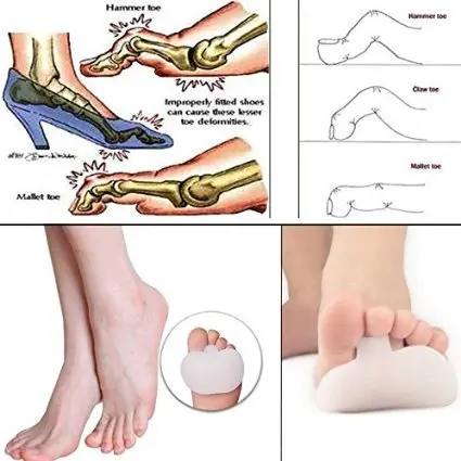 4Pcs Forefoot Shoes Cushion Pads High Heel Elastic Silicone Gel Insoles Orthotic Arch Support Pads Non Slip Relieve Pain D0737