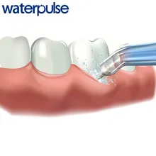Водный Пульс 1 шт. очиститель языка Стоматологический Ирригатор наконечник струи воды Denatl Flosser Сменные струйные наконечники оральные принадлежности для ирригатора
