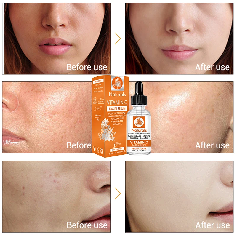 vitamin c after hyaluronic acid