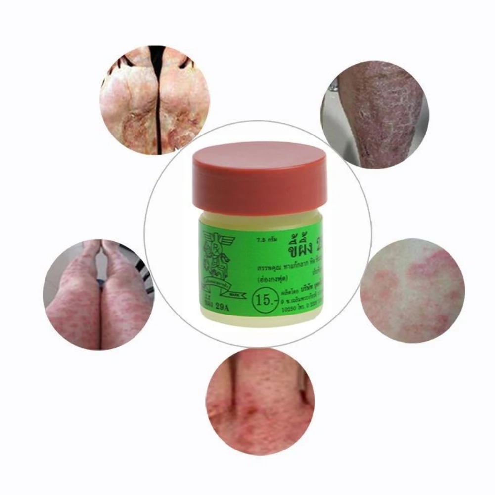 1 шт. китайская медицина псориаз Eczma крем кожа работает идеально для все виды кожи проблемы тела мазь для массажа 29A
