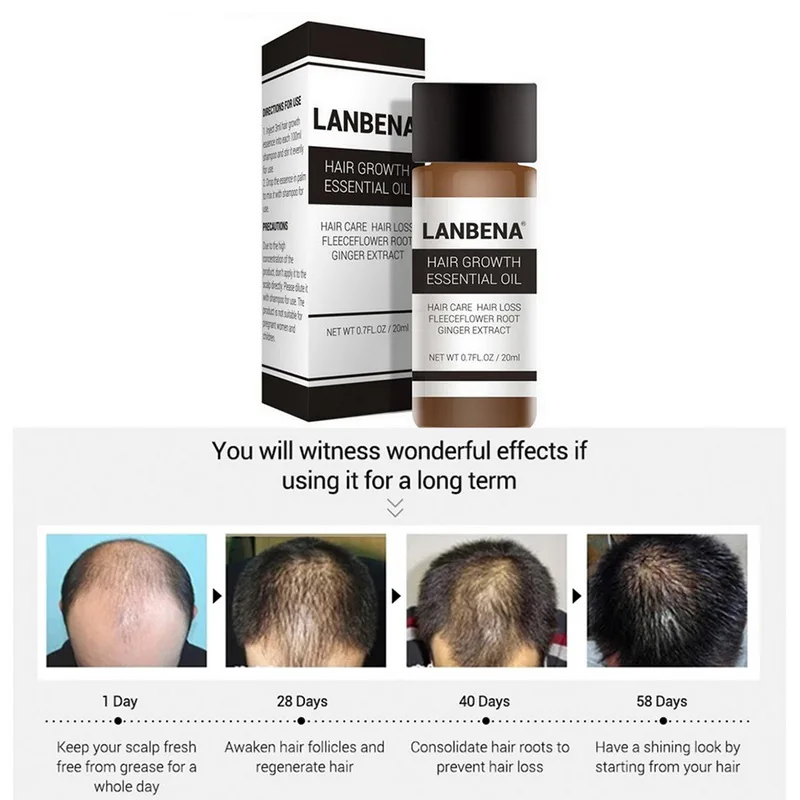 LANBENA 20ml Hair Growth Essence Fast Powerful Care Essential Oil Liquid Treatment Preventing Loss for Female Male | Красота и