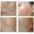 Новый Bioaqua 30g Anti Acne Cream Oil Control Shrink Pore Acnes Scar Remove Face Care SCI88