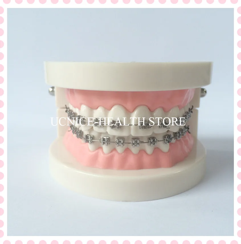 Orthodontic teeth model-2