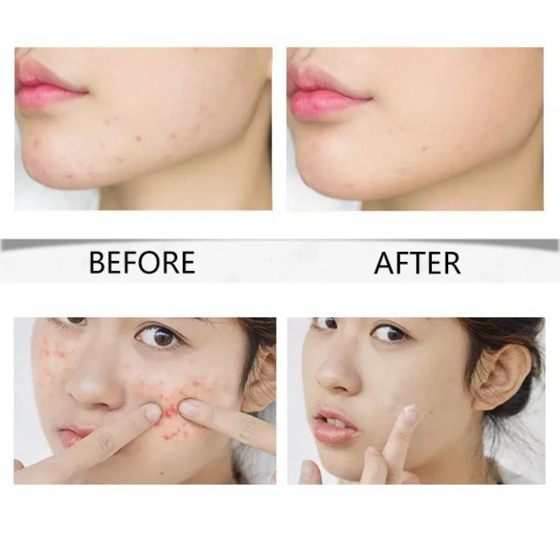 Facial Essence Hyaluronic Acid Stock Solution Moisturizing Firming Skin Smooth Fine Lines Face Serum Whitening Essential Liquid