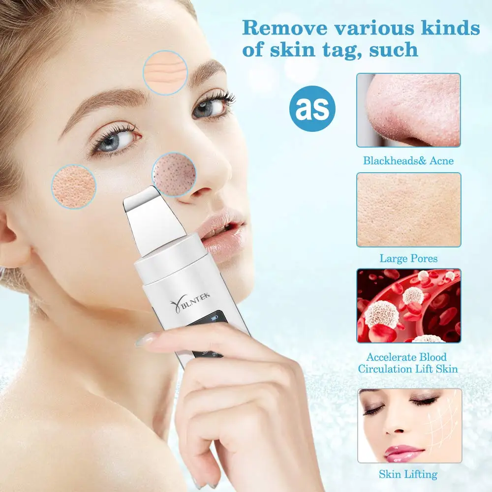 YBLNTEK Ultrasonic Skin Scrubber LED Facial Skin Scrubber Spatula Ultrasound Face Scraper Blackhead Remover Comedone Extractor 3