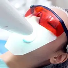 10 шт./упак. стоматологический рот, губы защита глаз гель светильник отбеливание зубов одноразовые анти-лекарства нагрудники салфетка медицинский Уход за полостью рта инструменты